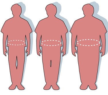 Trois silhouettes décrivant l&apos;écart entre la silhouette normale (à gauche), le surpoids (au milieu) et l&apos;obésité (à droite)