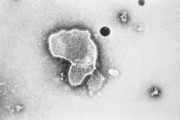 Photo : micrographie du virus le plus souvent en cause des bronchiolites et pneumonies chez les enfants de moins d&apos;un an