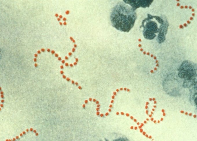 Photo : microphotographie de la bactérie Streptococcus pyogenes