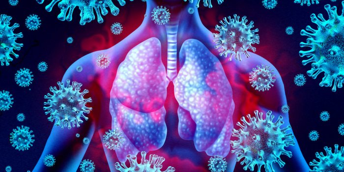 lung virus infection and coronavirus outbreak or viral pneumonia and coronaviruses influenza as a dangerous flu strain ca...