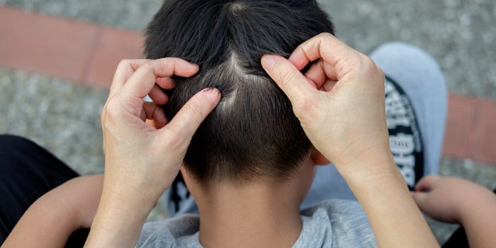 5 problÃ¨mes de santÃ© que les cheveux blancs peuvent prÃ©sager