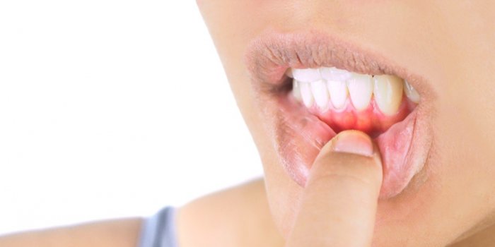 5 maladies graves que l'on peut repÃ©rer sur vos dents