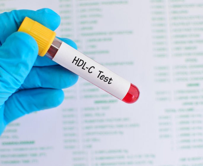 Taux de cholesterol : qu-est-ce que la lipoproteine HDL ?