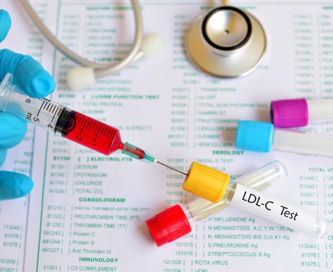 Taux de cholesterol : qu-est-ce que la lipoproteine LDL ?