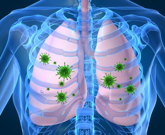 Pneumonie ou bronchite : la difference
