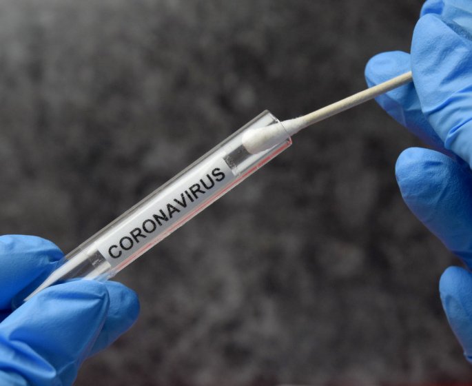 Coronavirus et depistage massif : qui est concerne ?