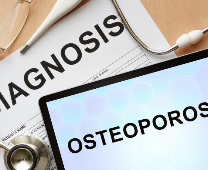 Fracture et osteoporose : 3 conseils