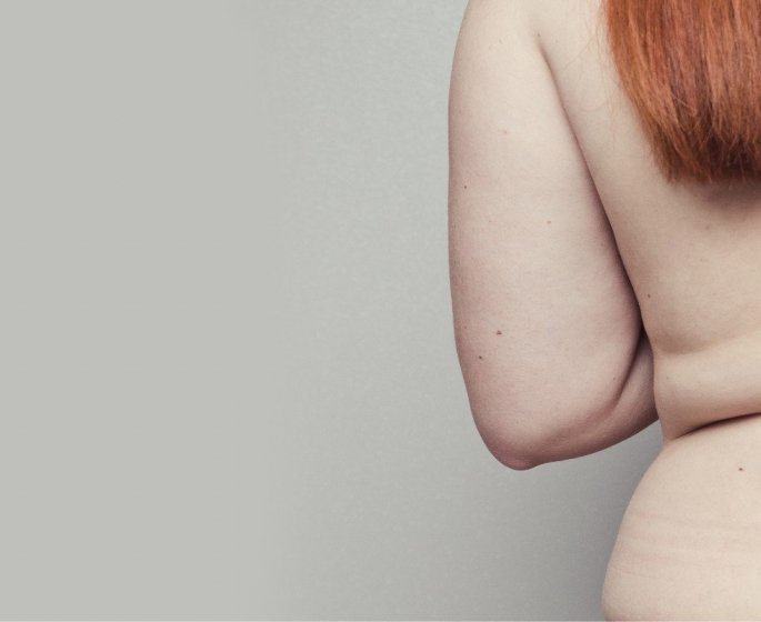 Journee mondiale contre l’obesite : 7 chiffres a connaitre