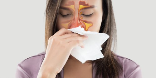 Sinusite : symptomes, causes, traitement et prevention