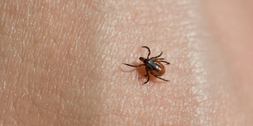 Maladie de Lyme : les repulsifs naturels contre les morsures de tiques 