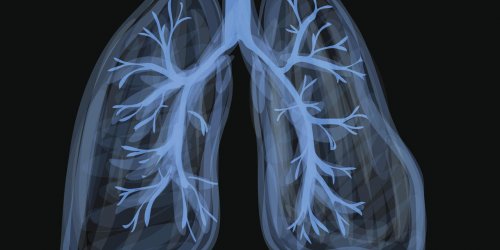 Bronchite asthmatiforme (asthmatique) : symptomes, causes, contagion et traitements