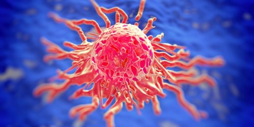 Pour la premiere fois un cas de cancer incurable en remission grace a l-immunotherapie
