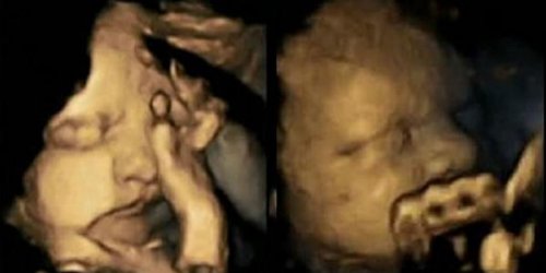 Images : ce foetus fait la grimace quand sa mere allume une cigarette