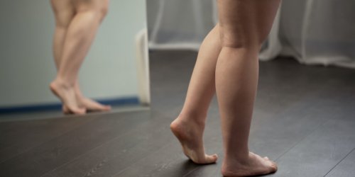 Maladie des jambes poteaux : 1 femme sur 10 souffre du lipoedeme en France