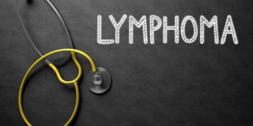 Cancer : les symptomes du lymphome de la rate