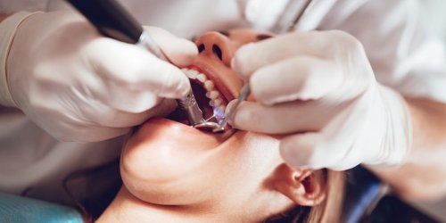 Parodontite : ce probleme dentaire qui augmente le risque de cancer