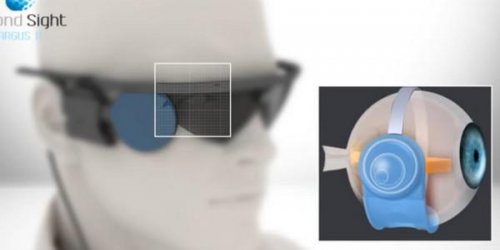 Video : Cet implant qui redonne la vue sera entierement rembourse