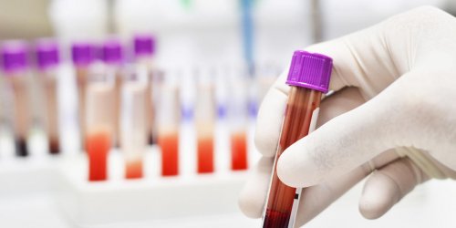 Analyse de sang : que sont les polynucleaires eosinophiles ?