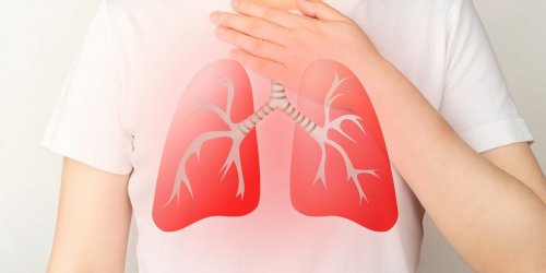 Embolie pulmonaire : comment la prevenir ?