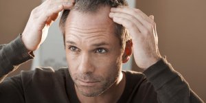 6 maladies qui font perdre les cheveux