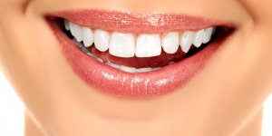 Bicarbonate pour avoir les dents blanches : les dangers