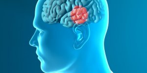 Parkinson : ils decouvrent comment reparer le cerveau abime