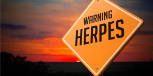Herpes genital : dois-je arreter de faire l-amour ?