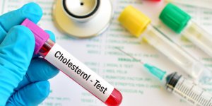 Cholesterol LDL et HDL : le bon rapport