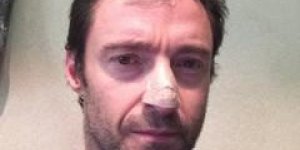 Hugh Jackman revele etre atteint d’un cancer de la peau
