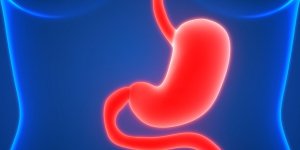 Reflux gastrique ou ulcere, comment les differencier ?