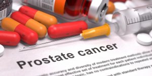 Traitements du cancer de la prostate : un risque d-impuissance ?
