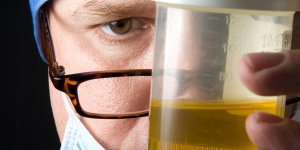 L-urine : des bienfaits pour la peau et contre la fatigue ? 