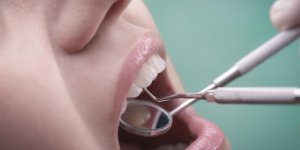 Prothese dentaire amovible : la pose a l-etranger dangereuse ? 