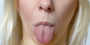 3 raisons qui vous donnent des aphtes sur la langue