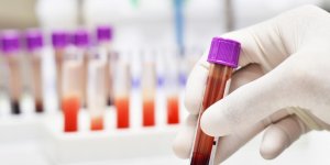 Analyse de sang : que sont les polynucleaires eosinophiles ?