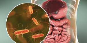 Bacterie E. coli : 5 aliments a surveiller pour eviter les risques