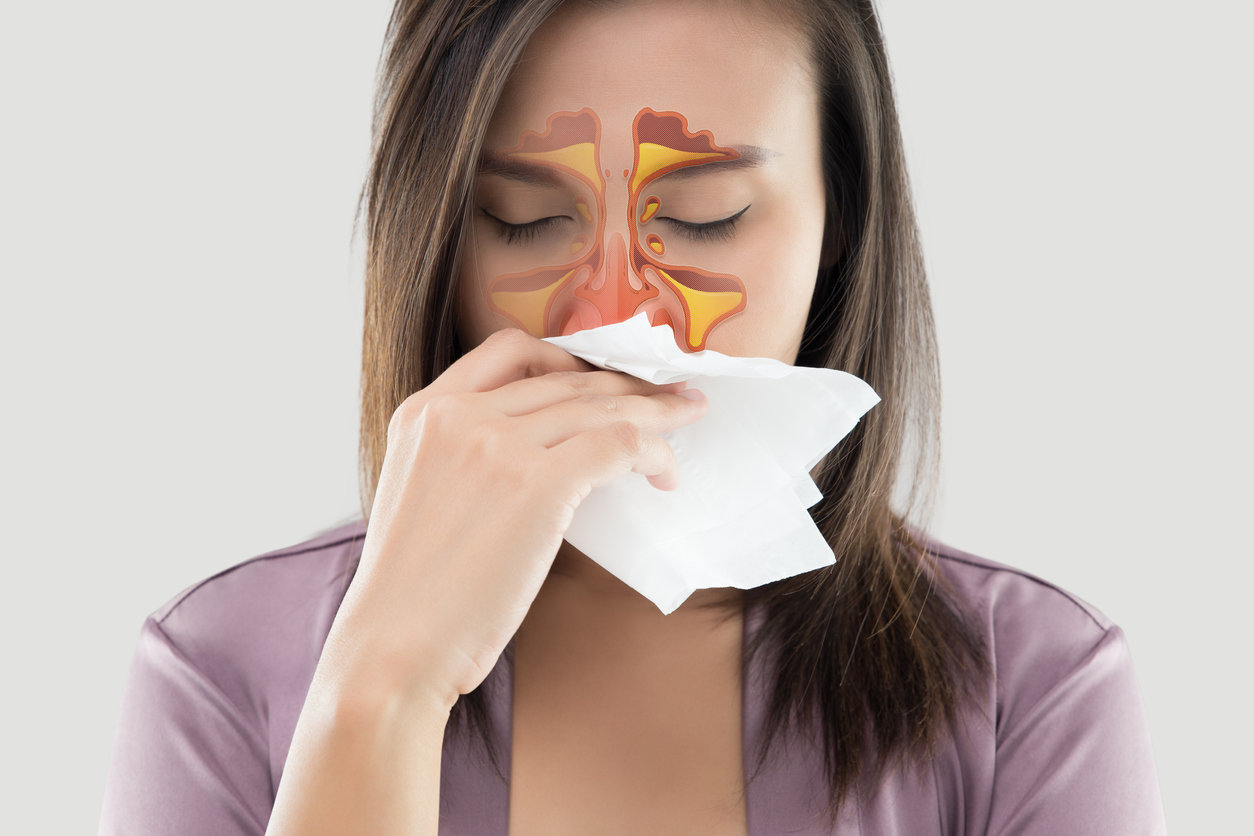 Sinusite : causes, symptômes & traitements