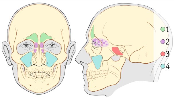 Illustration : 1- Les sinus frontaux : sous le front, 2- Les sinus ethmoïdaux : entre les yeux, 3- Les sinus sphénoïdaux : en arrière des yeux, 4- Les sinus maxillaires sous les pommettes