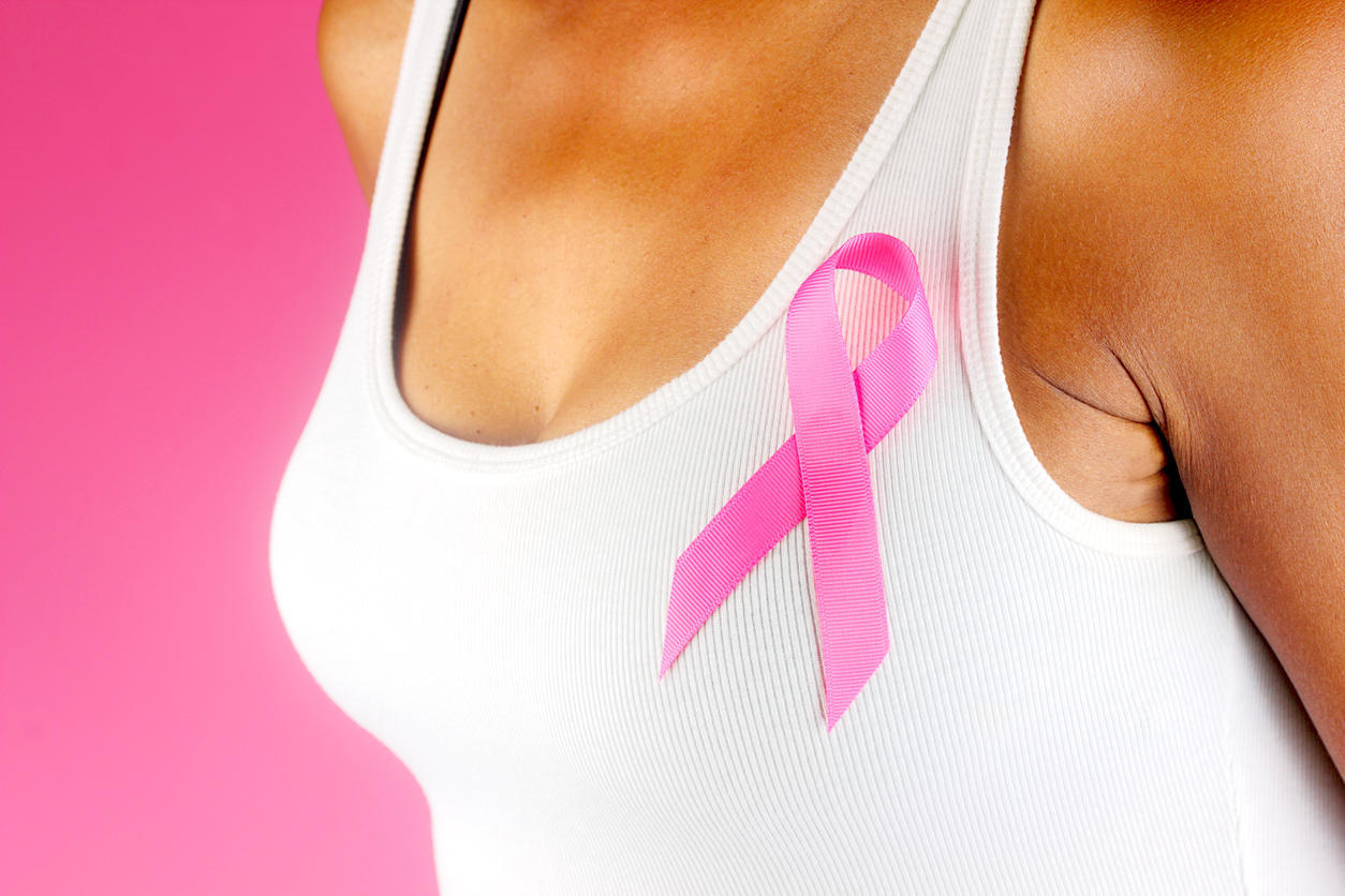 Cancer du sein de stade 3 : la définition