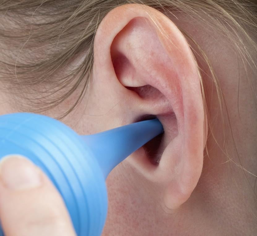 Oreille bouchée : comment enlever un bouchon de cire dans l