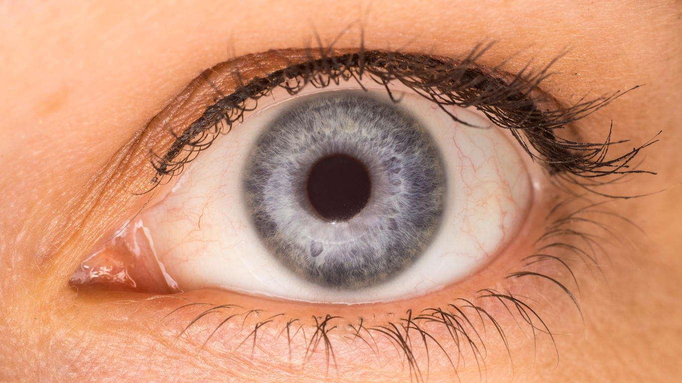 Maladie des yeux : la névrite optique