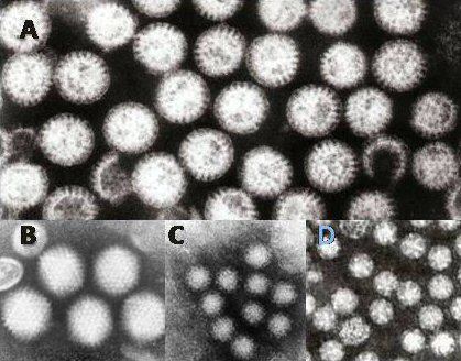 Différents virus de la gastro-entérite (A = rotavirus, B = adenovirus, C = Norovirus et D = Astrovirus) :