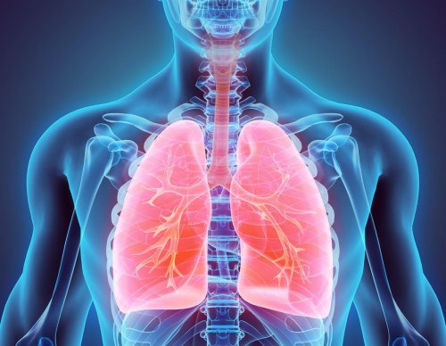 Le cancer du poumon : le plus meurtrier des cancers chez l&apos;homme et la femme