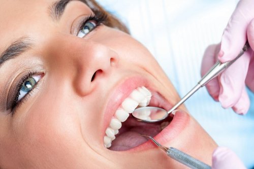 Dents blanches : pensez au d&eacute;tartrage !
