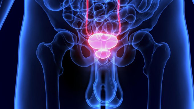 Prostate : Des bandelettes contre l'incontinence l&eacute;g&egrave;re