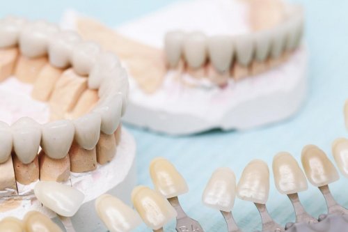 Prothèses dentaires : attention au temps d’accoutumance