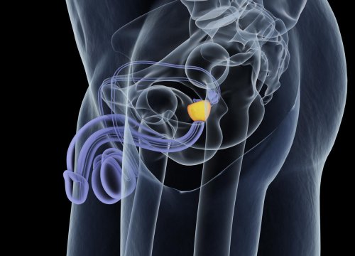 D&eacute;velopper une hypertrophie de la prostate