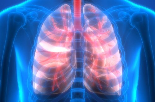 Cancer du poumon : un cas sur deux diagnostiqué au stade métastatique