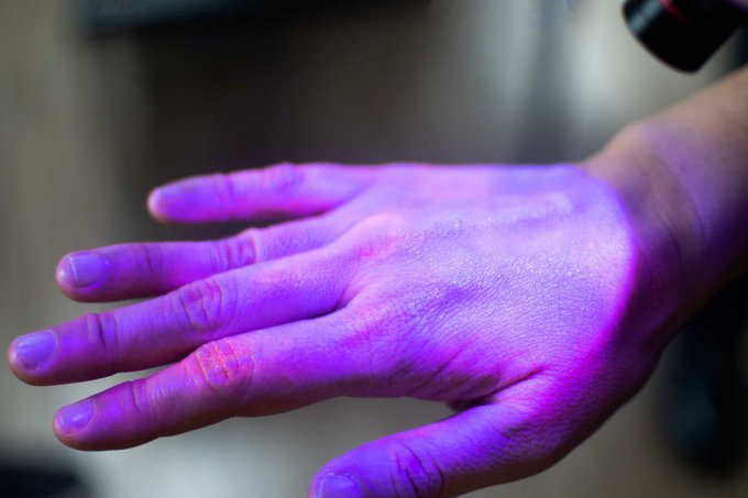 Ultraviolets : l&apos;OMS alerte contre leurs effets néfastes 