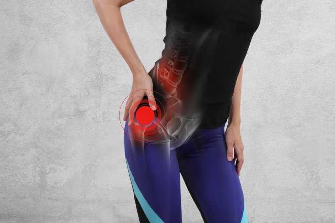woman with hip joint pain sport exercising injury